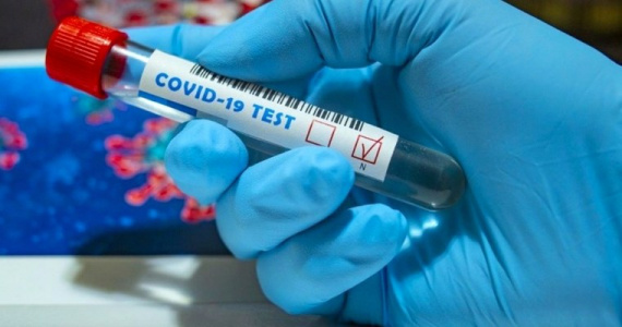 Изменение сроков проведения лабораторного исследования на COVID-19