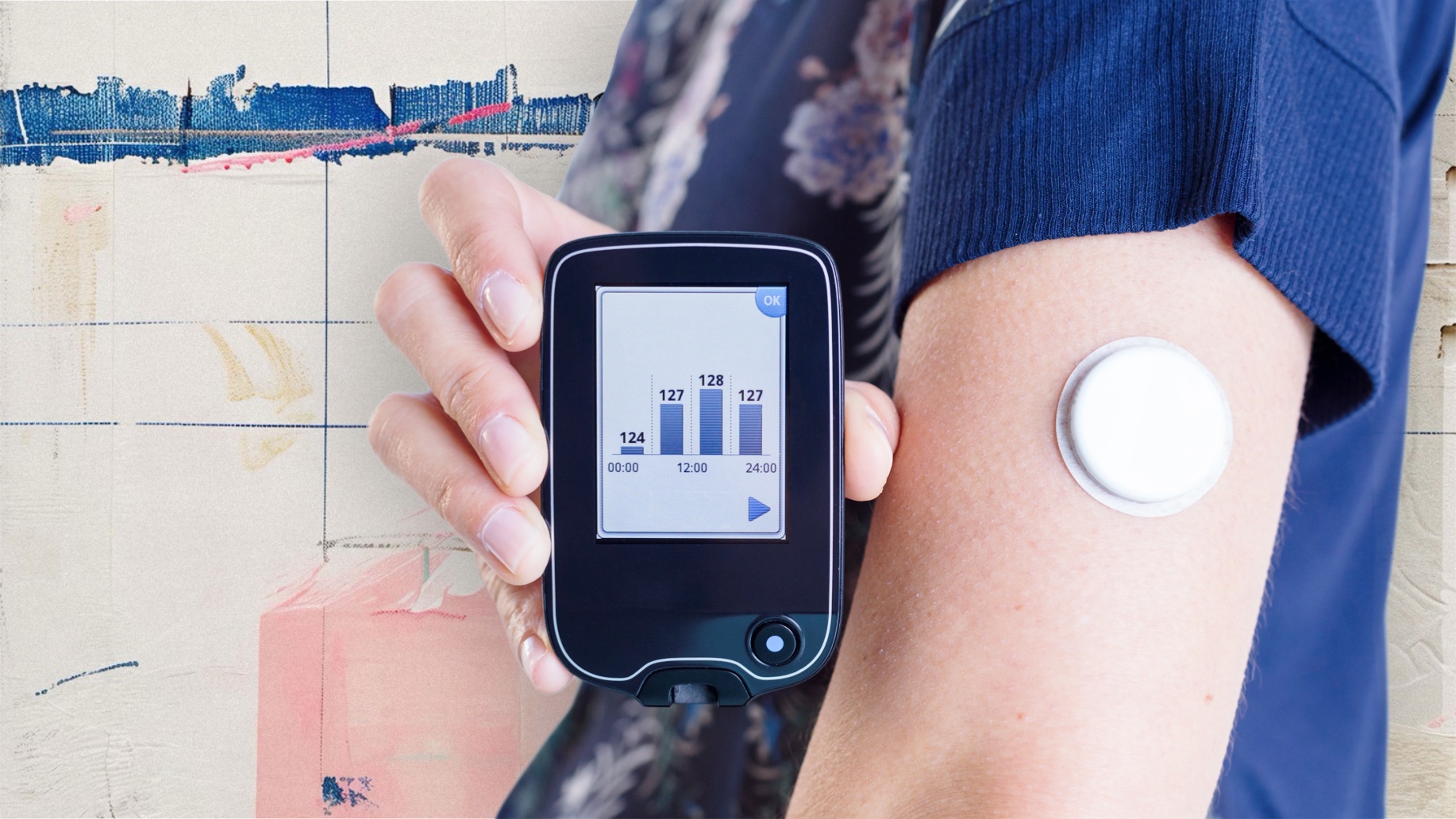 cgm трекер, диабет трекер, трекер для уровня сахара в крови, cgm, диабет